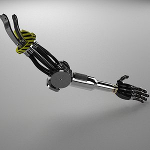 3D prosthetic arm