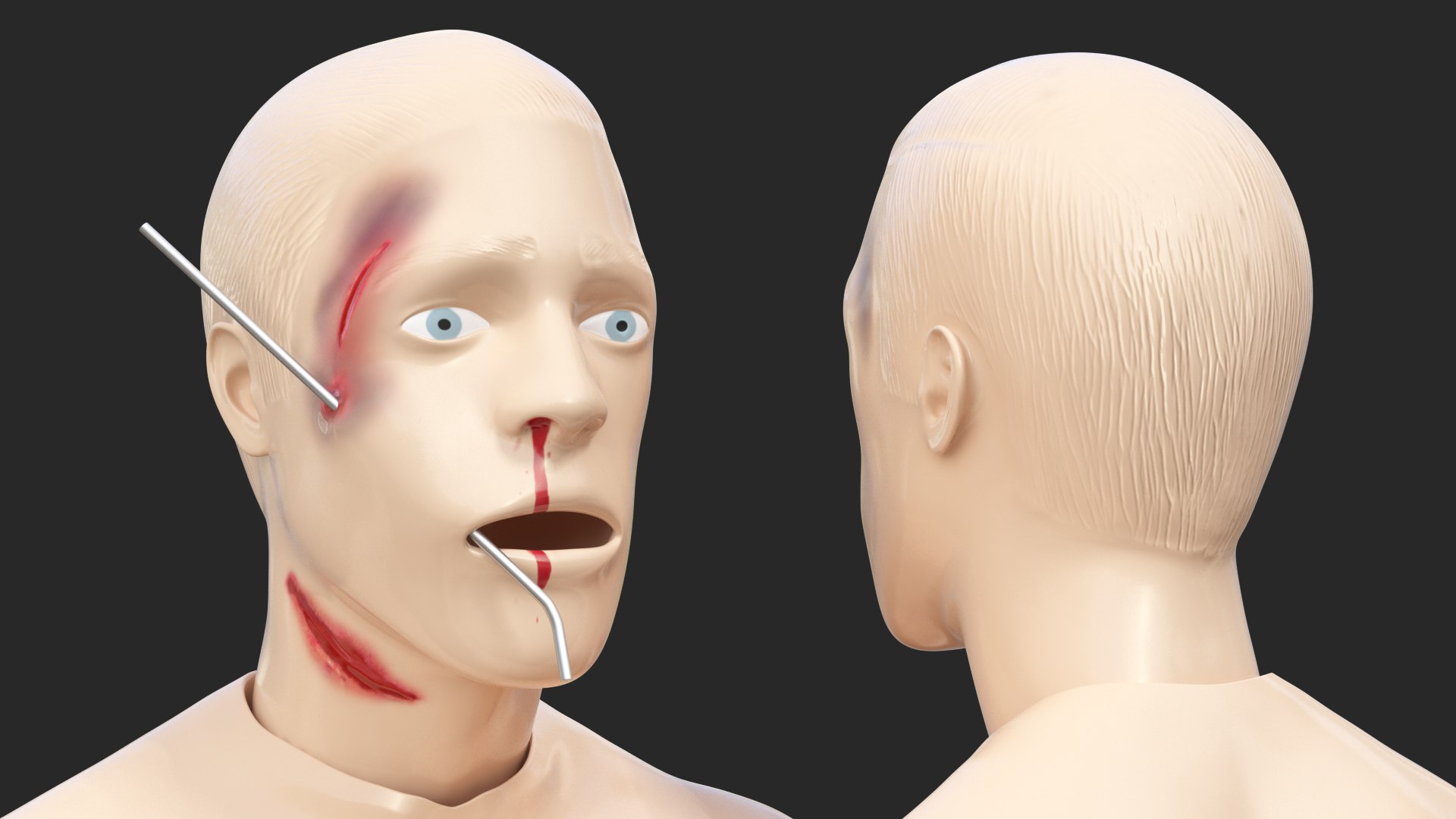 trauma extrication manikin t-pose 3D model https://p.turbosquid.com/ts-thumb/Wq/PI79as/Myud5NtJ/traumaandextricationmanikintposec4dmodel016/jpg/1582318423/1920x1080/fit_q87/e8a10b18c760a065cfe2900858807c8e2e231bfa/traumaandextricationmanikintposec4dmodel016.jpg