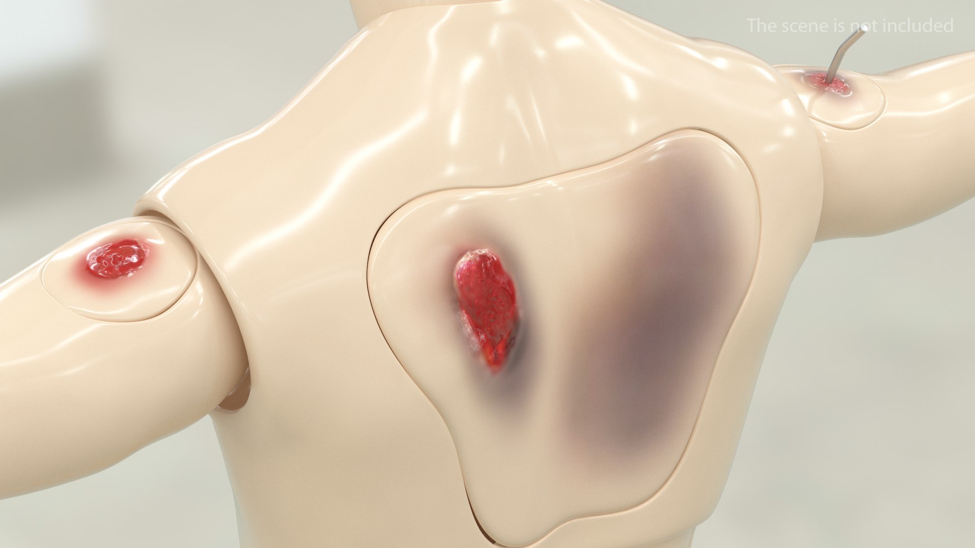 trauma extrication manikin t-pose 3D model https://p.turbosquid.com/ts-thumb/Wq/PI79as/YhpgGtqF/traumaandextricationmanikintposec4dmodel009/jpg/1582318382/1920x1080/fit_q87/975361b855ff2155e934074e71e293977d58f961/traumaandextricationmanikintposec4dmodel009.jpg