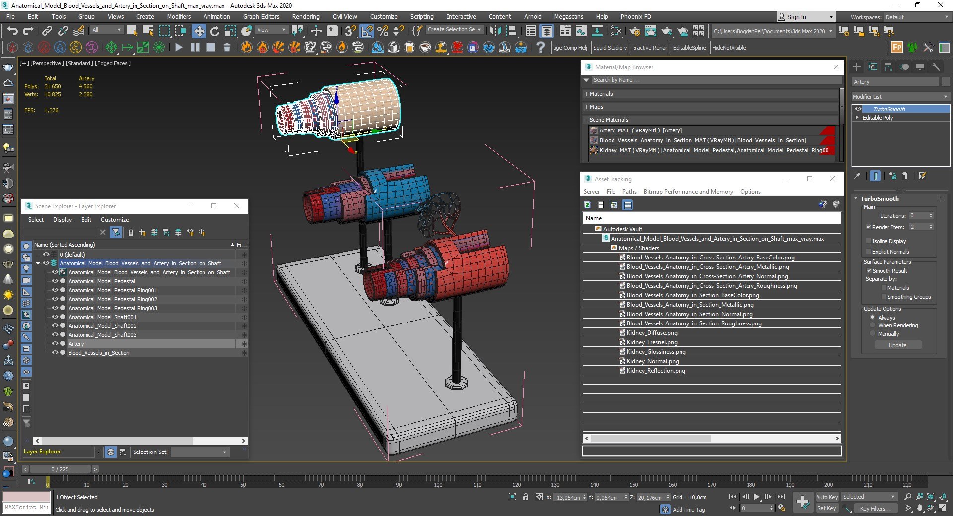 3D model Anatomical Model Blood Vessels and Artery in Section on Shaft https://p.turbosquid.com/ts-thumb/Wr/jnoym0/Bk/anatomical_model_blood_vessels_and_artery_in_section_on_shaft_015/jpg/1744056187/1920x1080/fit_q87/e2acfff2c268d6412089f4f866975009bddf6392/anatomical_model_blood_vessels_and_artery_in_section_on_shaft_015.jpg