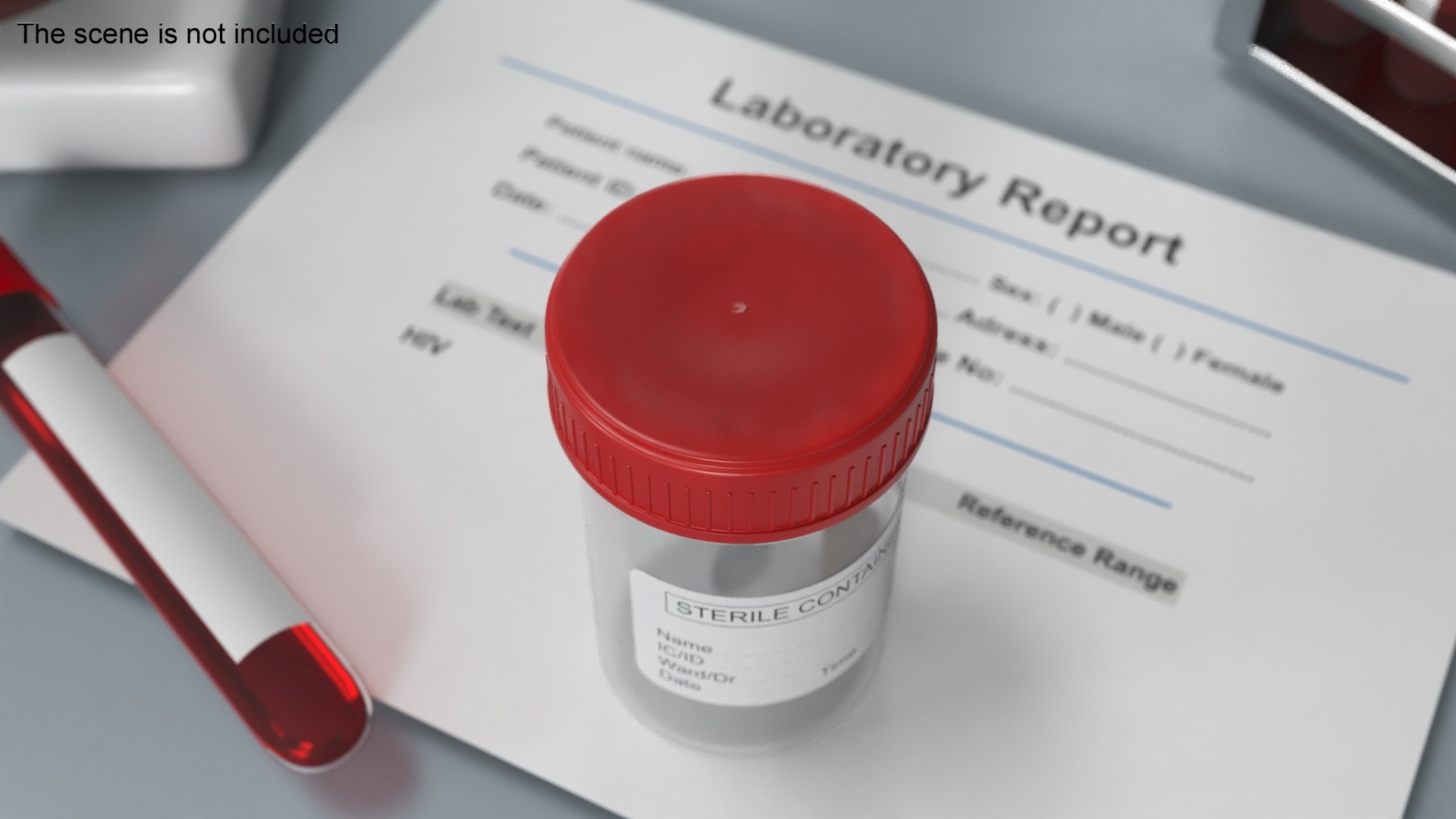 Stool Sample Container 3D model https://p.turbosquid.com/ts-thumb/XA/3OSxDr/FL/stool_sample_container_003/jpg/1747854148/1920x1080/fit_q87/1a7815d774f7b62d3999519d38e58a05d54b23c0/stool_sample_container_003.jpg