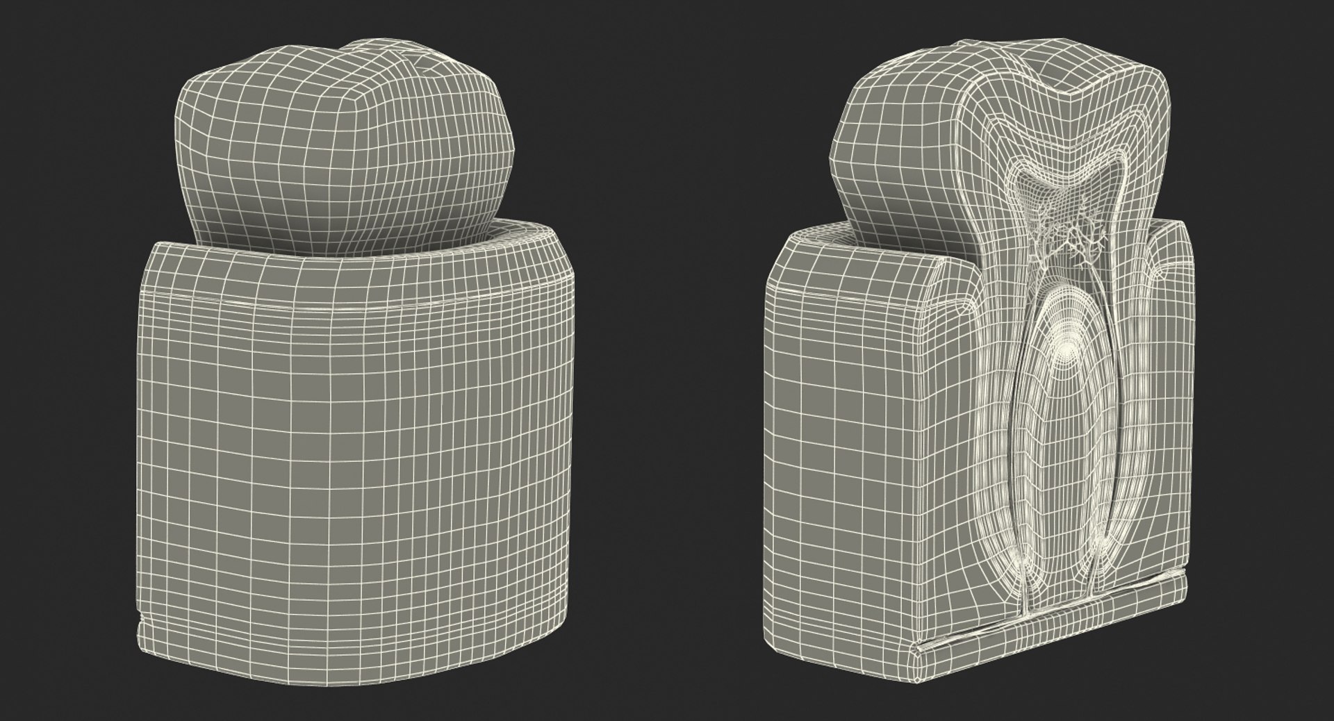 dental 3 3D https://p.turbosquid.com/ts-thumb/XL/uMHi1R/BOs2uxsO/dentalcollection33dmodel062/jpg/1543060956/1920x1080/fit_q87/c8166c89f7c4842b54fb259c3cd31dd37e181da2/dentalcollection33dmodel062.jpg