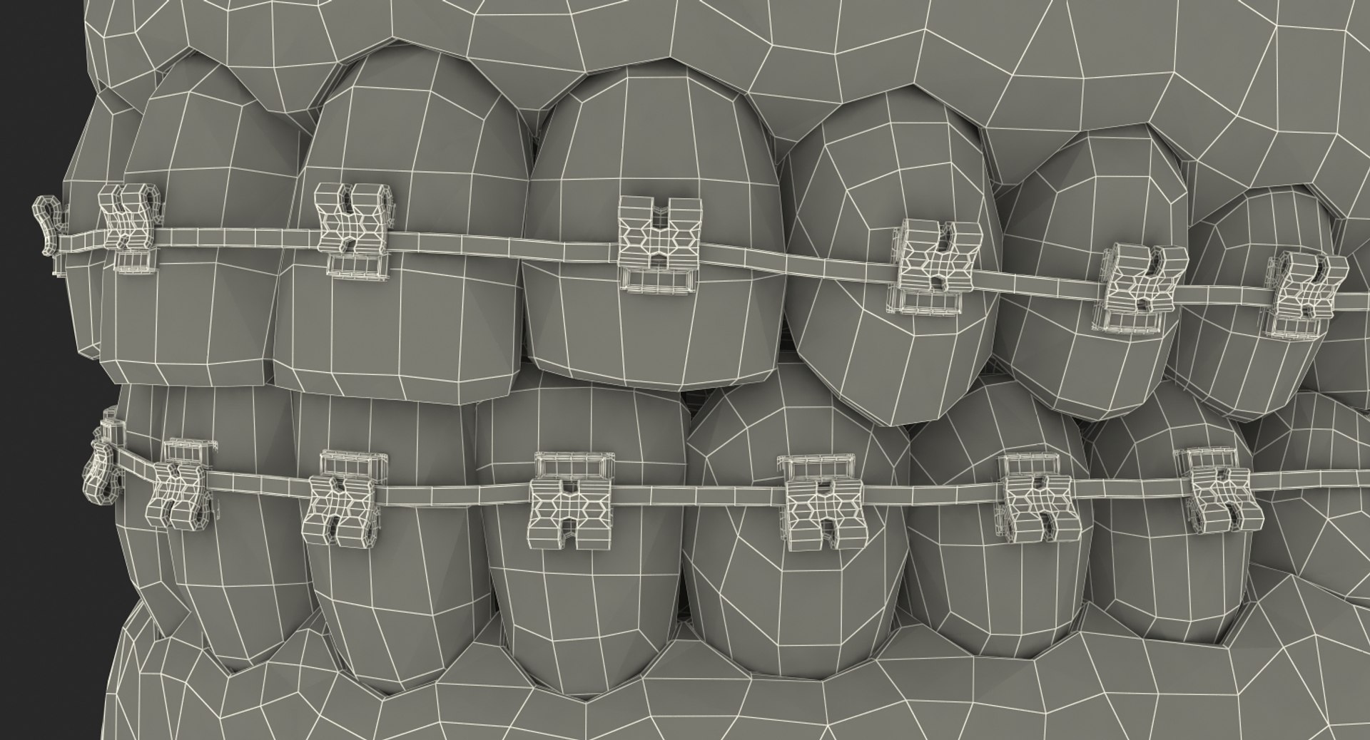 dental 3 3D https://p.turbosquid.com/ts-thumb/XL/uMHi1R/NjXgCQMM/dentalcollection33dmodel059/jpg/1543060955/1920x1080/fit_q87/cf1c2979f0eac090a9b50b176a18bddd0cdeafd5/dentalcollection33dmodel059.jpg