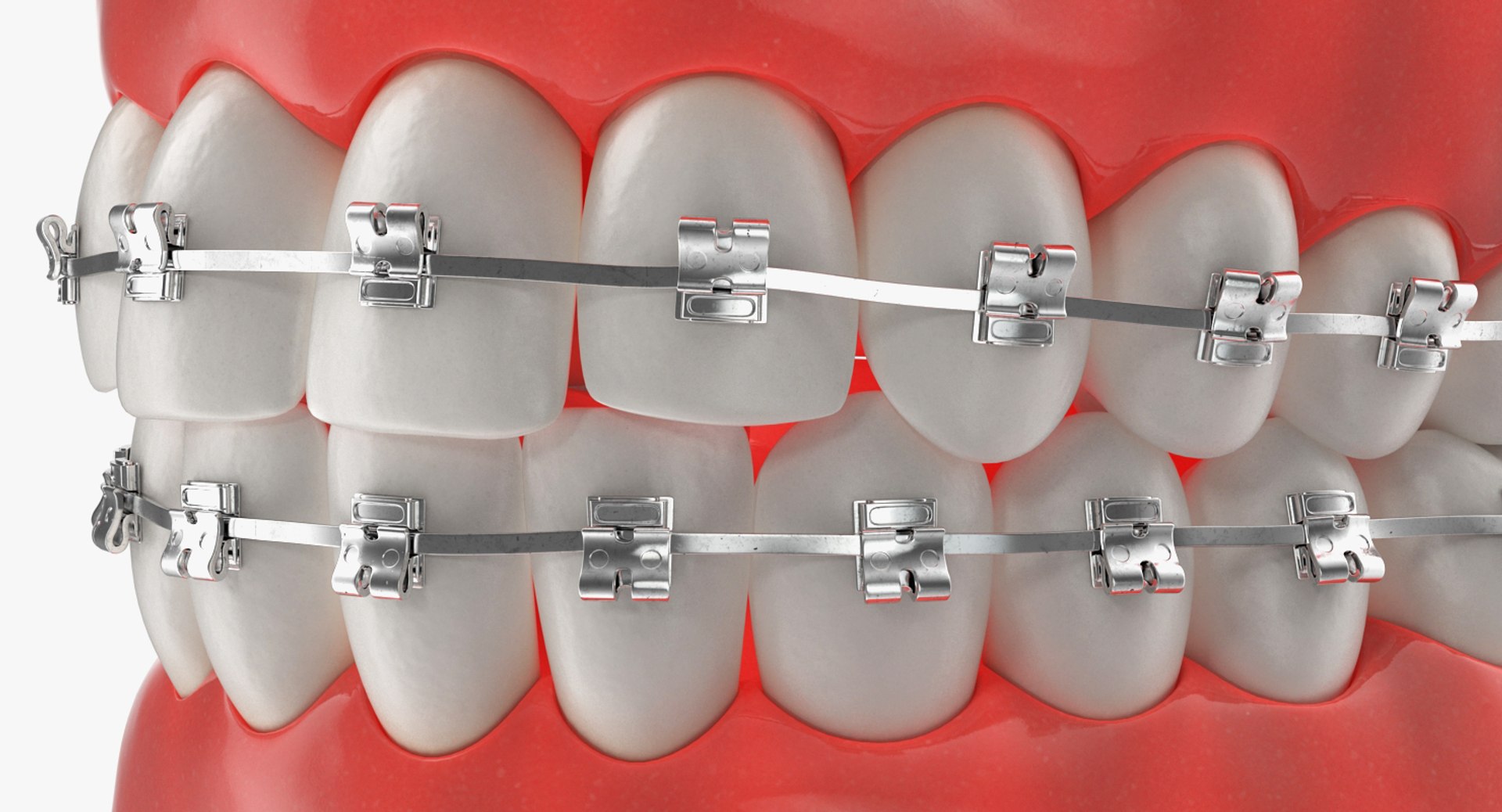 dental 3 3D https://p.turbosquid.com/ts-thumb/XL/uMHi1R/V7nuROdR/dentalcollection33dmodel023/jpg/1543060937/1920x1080/fit_q87/5cd7642b59887c8253f5a77f595ef52406a75a41/dentalcollection33dmodel023.jpg