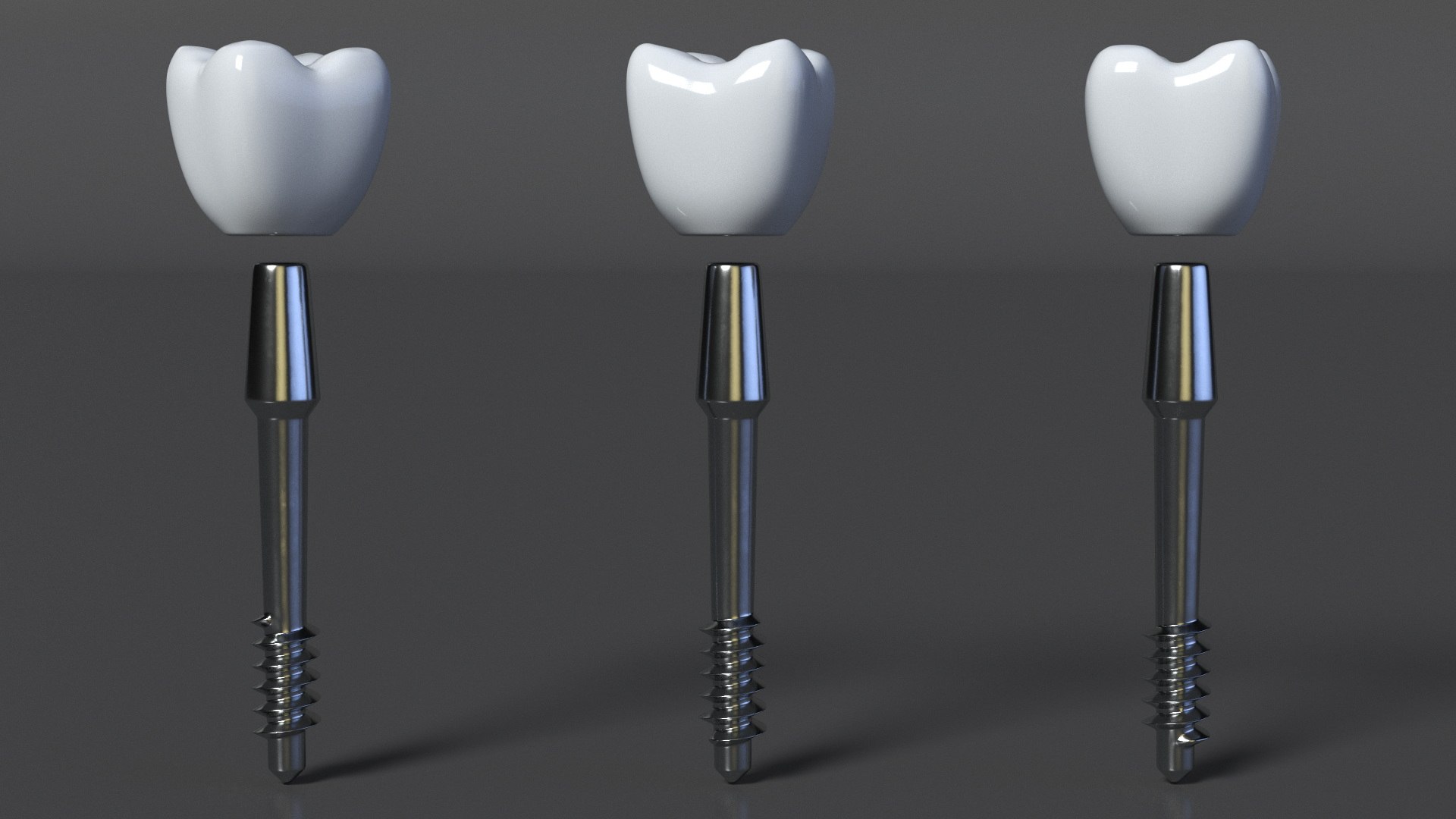 3D Tooth Implants Collection 4 https://p.turbosquid.com/ts-thumb/XR/EkHB9y/AX/toothimplantscollection43dmodel030/jpg/1706530608/1920x1080/fit_q87/8fe00f0ec910b901dede3dab128f6bbb6c5e5b31/toothimplantscollection43dmodel030.jpg