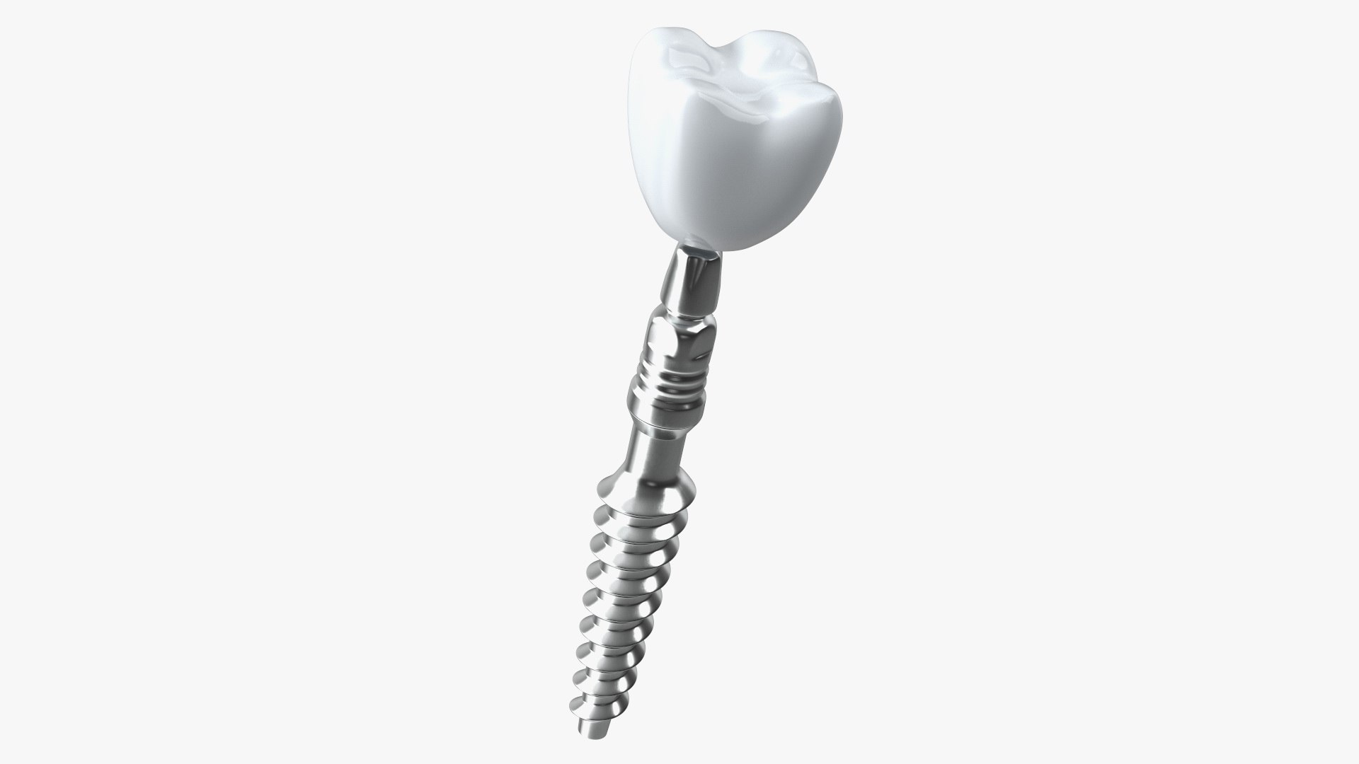 3D Tooth Implants Collection 4 https://p.turbosquid.com/ts-thumb/XR/EkHB9y/D4/toothimplantscollection43dmodel044/jpg/1706530670/1920x1080/fit_q87/e81ddb38013cddba492c5e3d7a46529eab8c4f9d/toothimplantscollection43dmodel044.jpg
