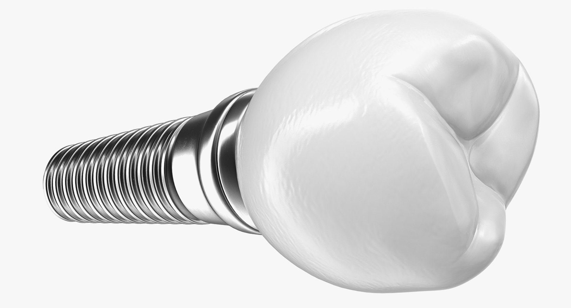 3D Tooth Implants Collection 4 https://p.turbosquid.com/ts-thumb/XR/EkHB9y/Ge/toothimplantscollection43dmodel080/jpg/1706530830/1920x1080/fit_q87/b1bf43d9e5838a77d8870dc211a8ddead0a92a0d/toothimplantscollection43dmodel080.jpg