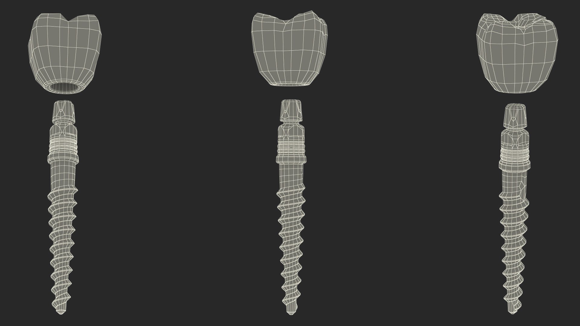 3D Tooth Implants Collection 4 https://p.turbosquid.com/ts-thumb/XR/EkHB9y/HN/toothimplantscollection43dmodel104/jpg/1706530939/1920x1080/fit_q87/af0dee34d93c8c3c48a4f03fbf97293ed43e99a2/toothimplantscollection43dmodel104.jpg