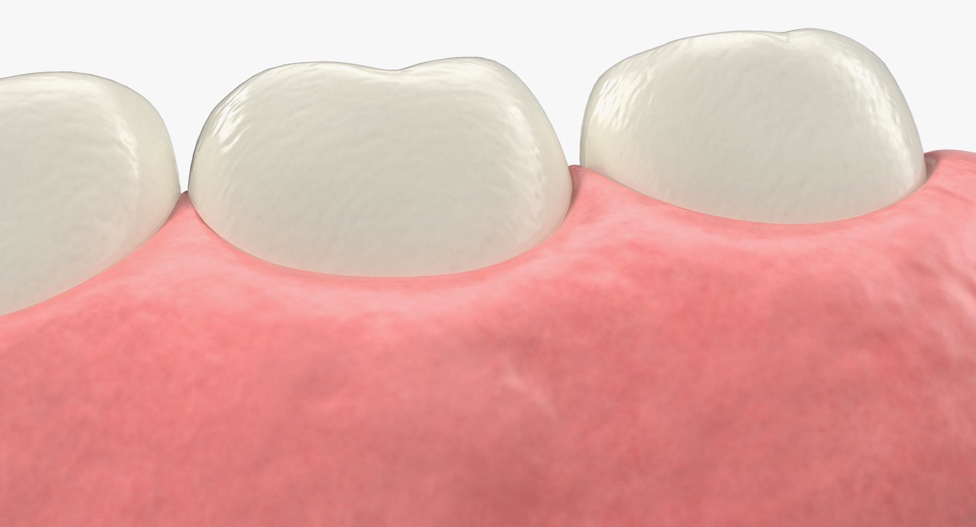 3D Tooth Implants Collection 4 https://p.turbosquid.com/ts-thumb/XR/EkHB9y/Kg/toothimplantscollection43dmodel067/jpg/1706530775/1920x1080/fit_q87/2ef1fe70d90b00de4ed445fae2a819a4afa32b87/toothimplantscollection43dmodel067.jpg