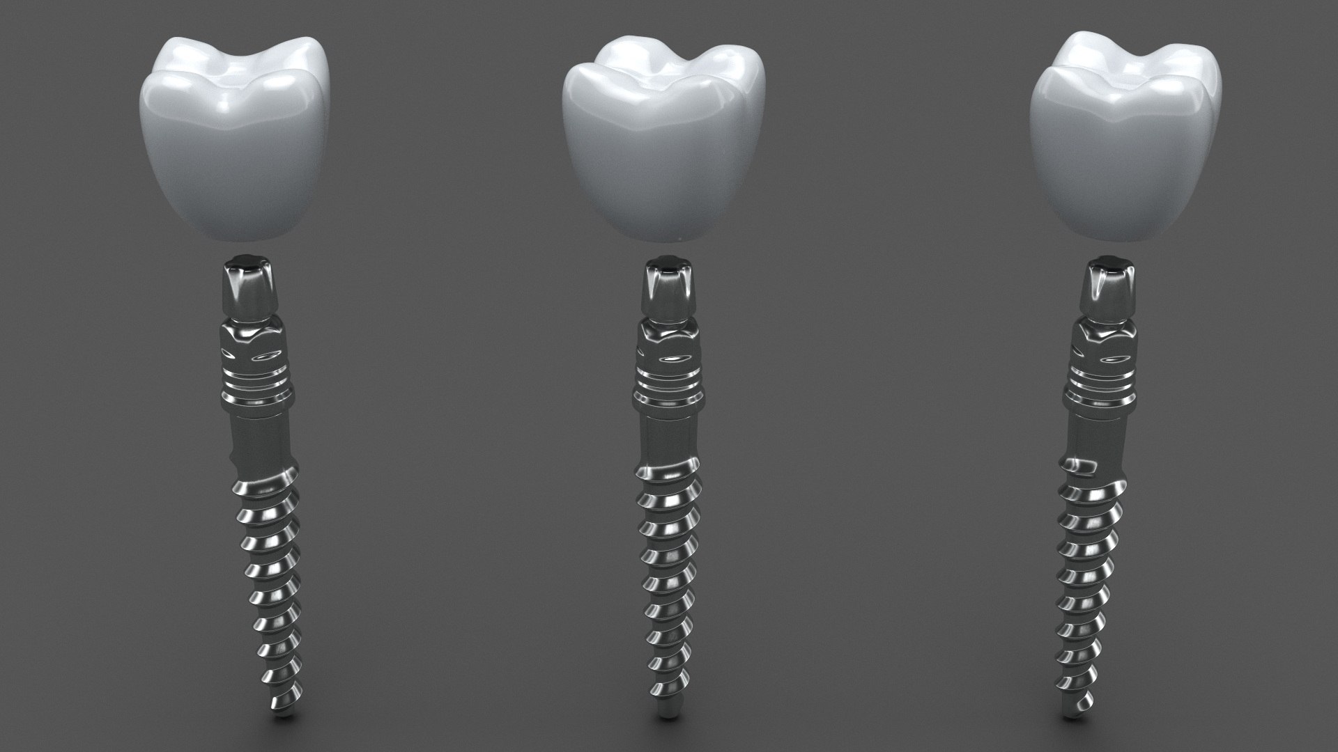 3D Tooth Implants Collection 4 https://p.turbosquid.com/ts-thumb/XR/EkHB9y/Kx/toothimplantscollection43dmodel018/jpg/1706530555/1920x1080/fit_q87/d852dcbfff9bf062c962db8b03a6a1086cbe1fb8/toothimplantscollection43dmodel018.jpg