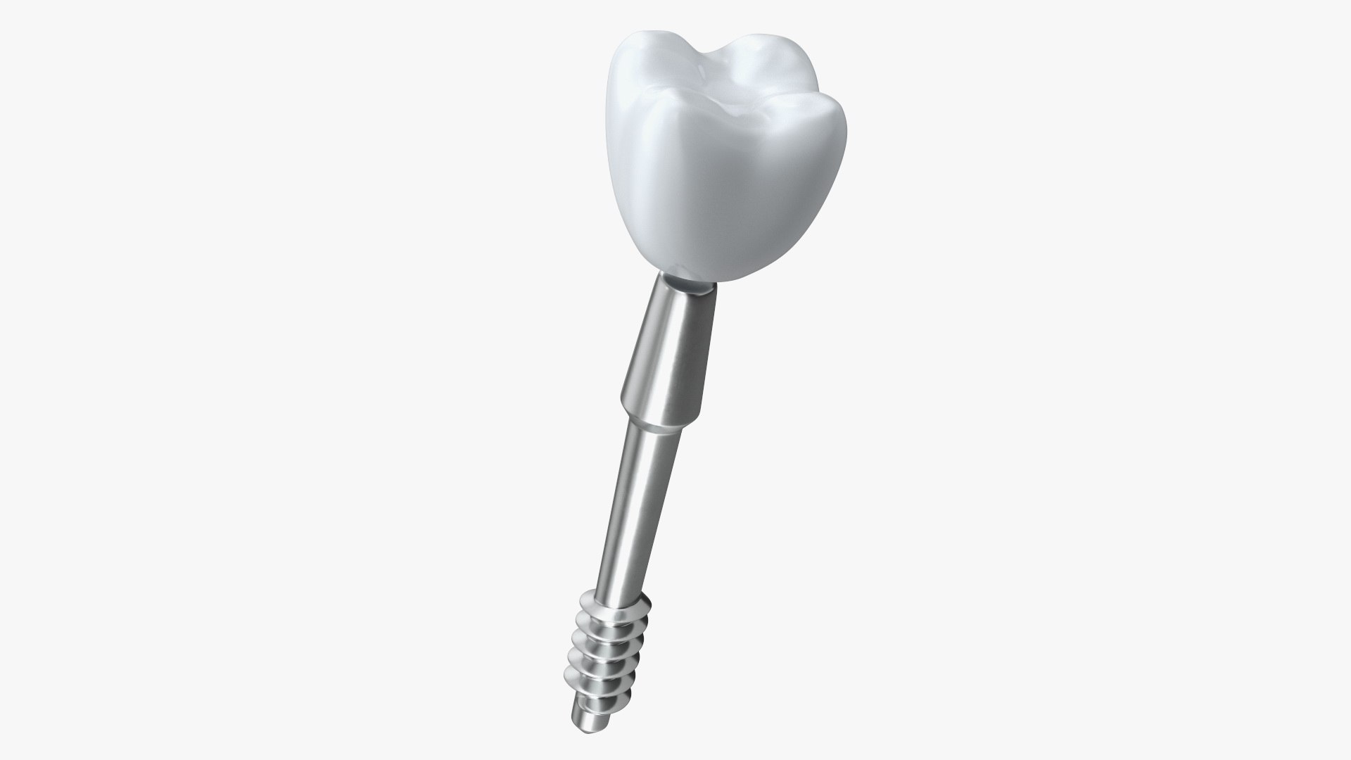 3D Tooth Implants Collection 4 https://p.turbosquid.com/ts-thumb/XR/EkHB9y/P3/toothimplantscollection43dmodel032/jpg/1706530617/1920x1080/fit_q87/1919ab7c1ed39dd7733e1a9f26fb2dbb45f1188a/toothimplantscollection43dmodel032.jpg