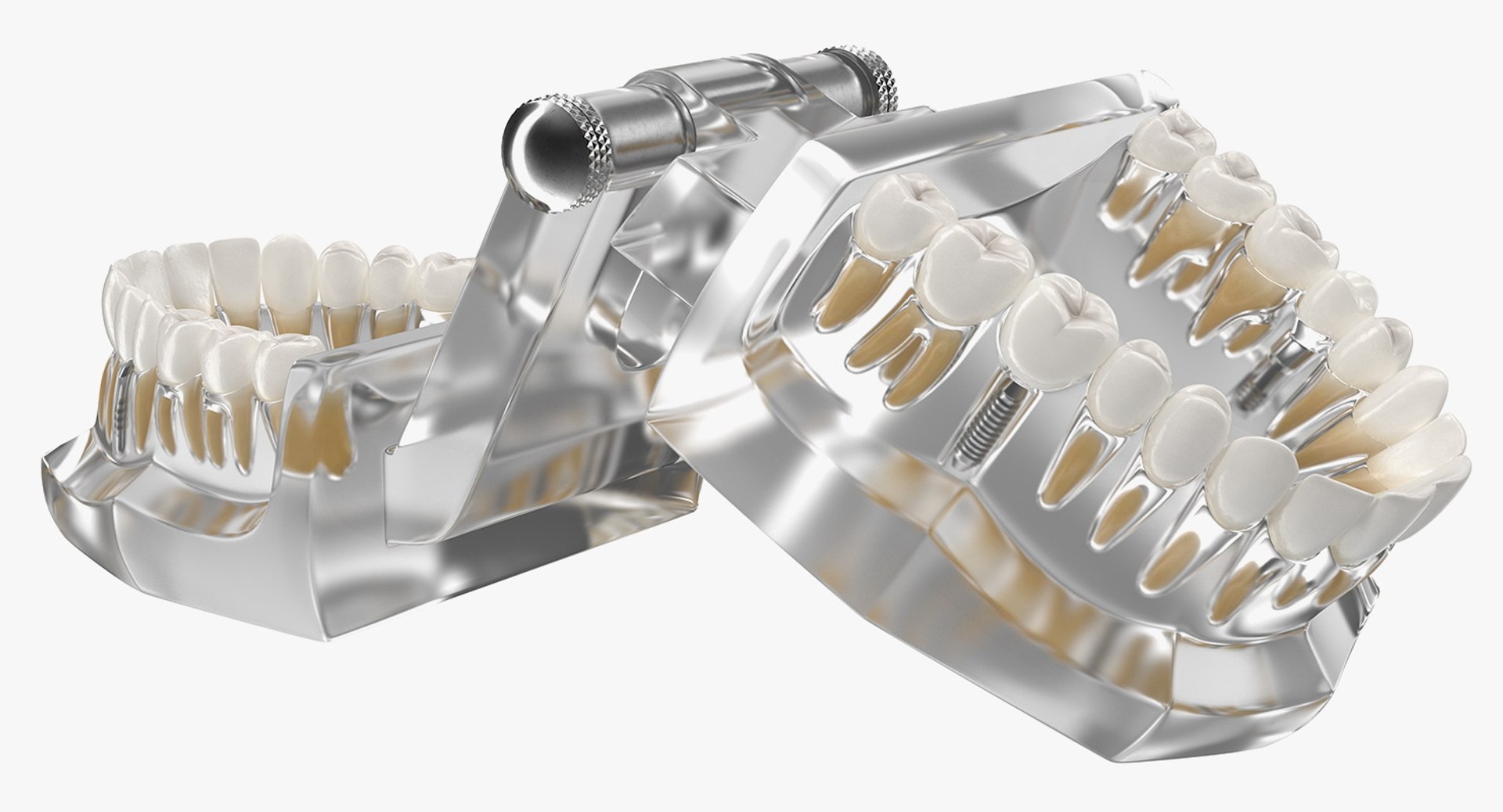 3D Tooth Implants Collection 4 https://p.turbosquid.com/ts-thumb/XR/EkHB9y/RT/toothimplantscollection43dmodel101/jpg/1706530925/1920x1080/fit_q87/a740a1c67d3b4a7b1e5f3c9a933bfca88089bdcf/toothimplantscollection43dmodel101.jpg