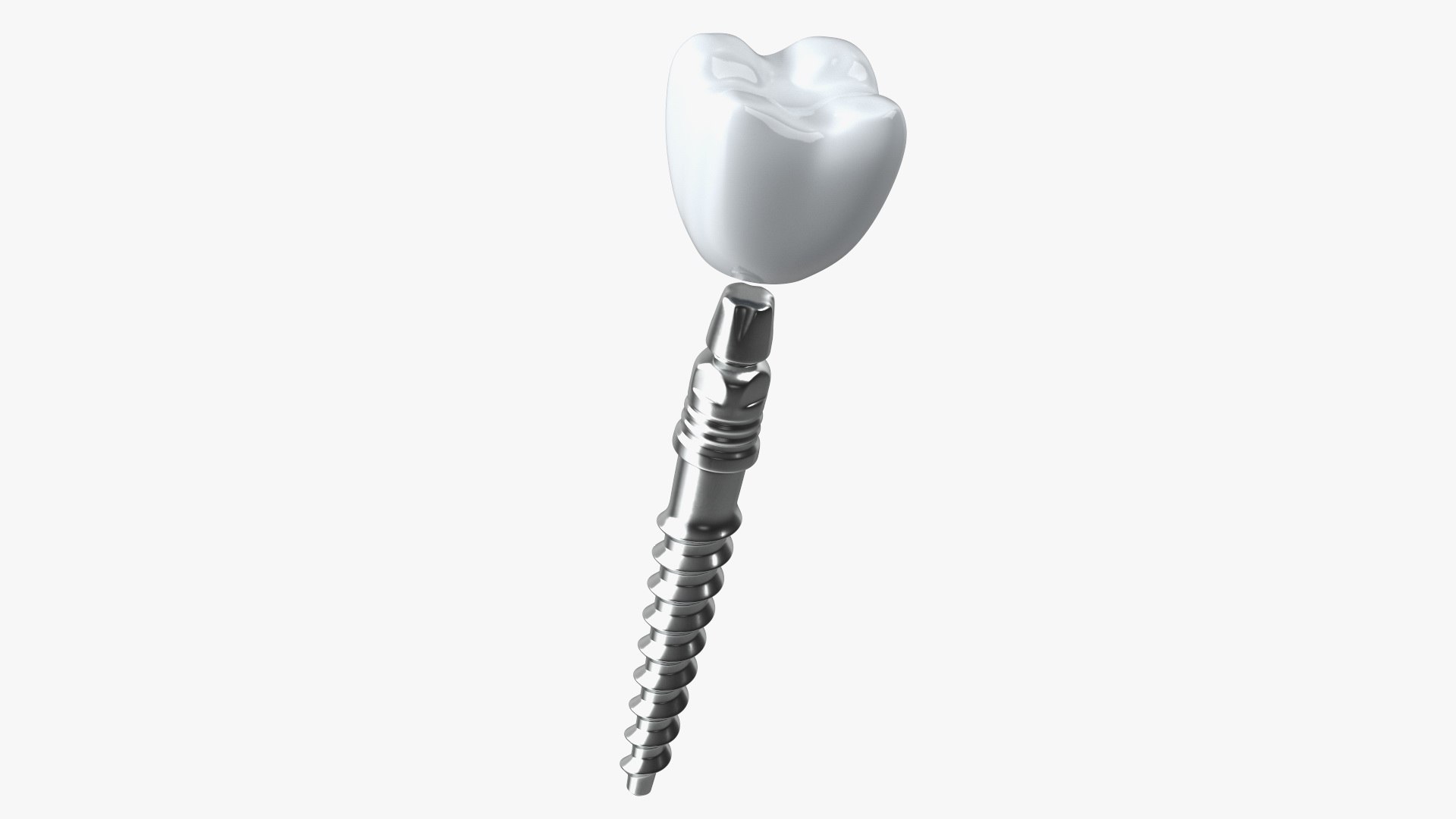 3D Tooth Implants Collection 4 https://p.turbosquid.com/ts-thumb/XR/EkHB9y/X3/toothimplantscollection43dmodel021/jpg/1706530569/1920x1080/fit_q87/11fb5c9b8a3bbca40e74abdf51296fd987370dde/toothimplantscollection43dmodel021.jpg