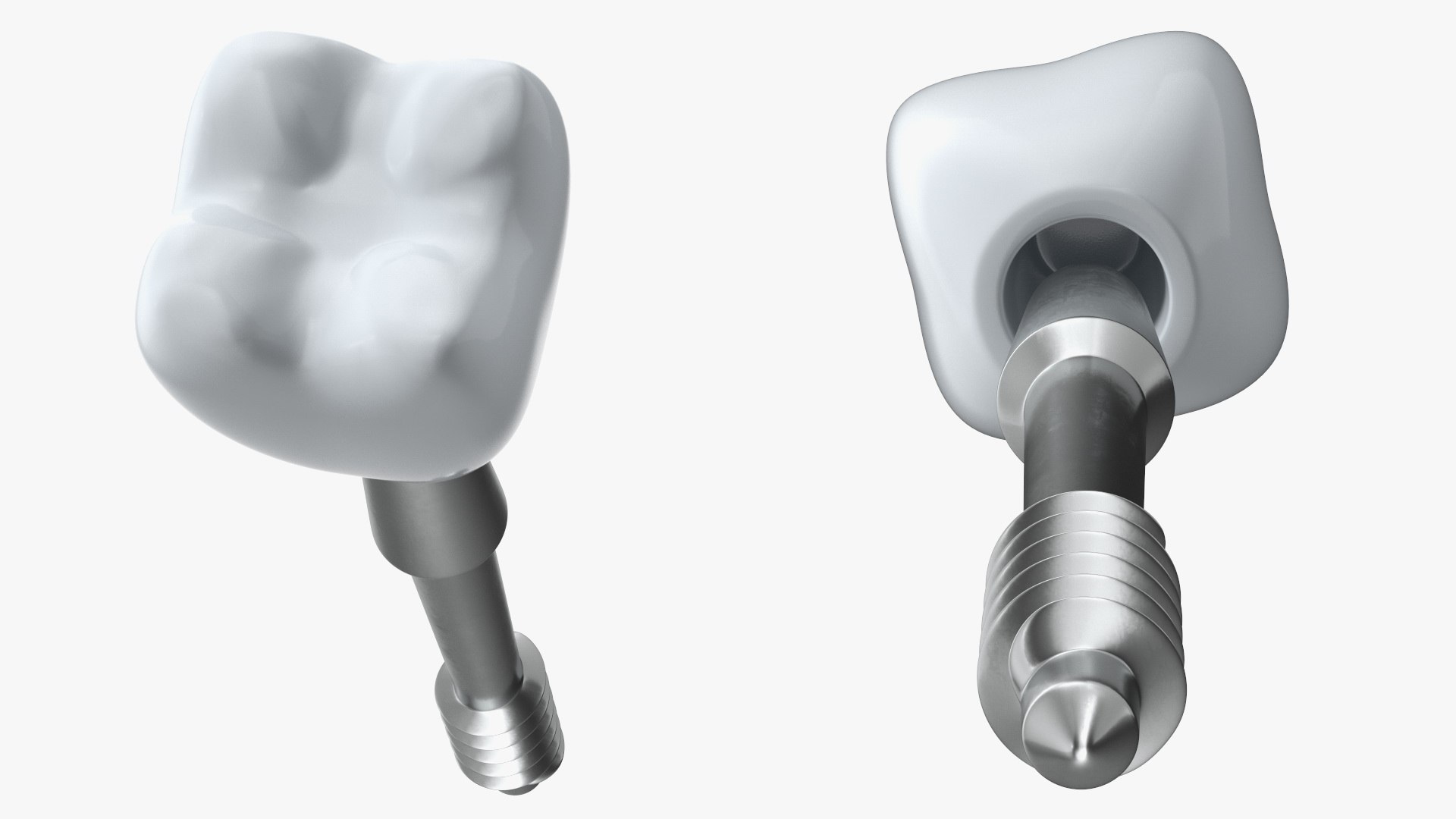 3D Tooth Implants Collection 4 https://p.turbosquid.com/ts-thumb/XR/EkHB9y/Yl/toothimplantscollection43dmodel033/jpg/1706530623/1920x1080/fit_q87/aa4a03cfc922fcb7bb1d454c999e548f5d84a0a1/toothimplantscollection43dmodel033.jpg