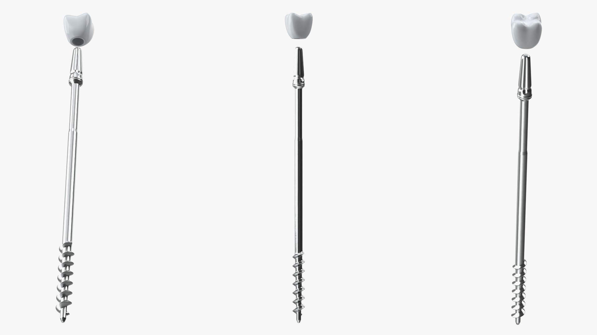 3D Tooth Implants Collection 4 https://p.turbosquid.com/ts-thumb/XR/EkHB9y/je/toothimplantscollection43dmodel009/jpg/1706530515/1920x1080/fit_q87/d4f72f73659b24f229ff9648b4e5c766e253d989/toothimplantscollection43dmodel009.jpg