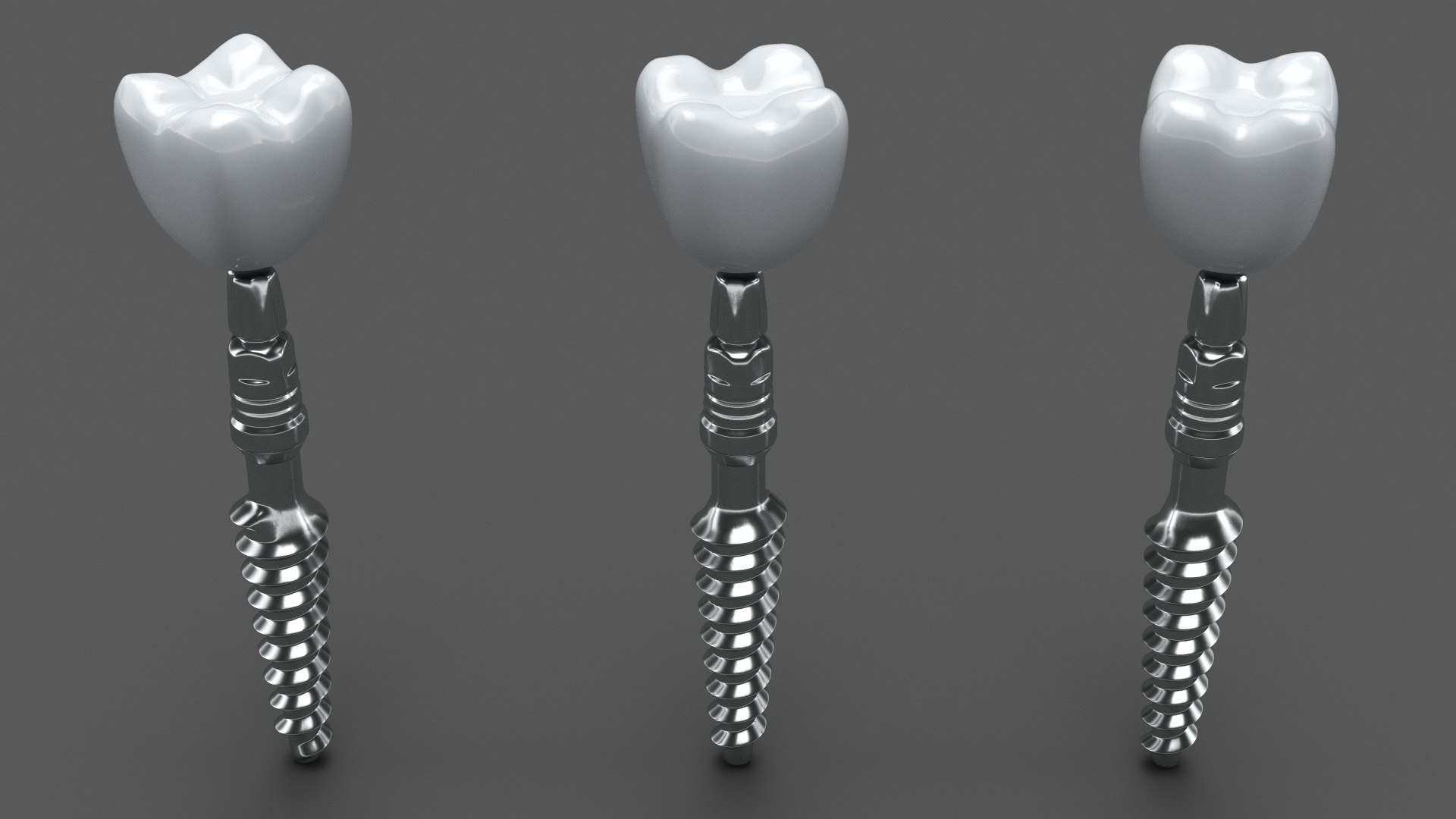 3D Tooth Implants Collection 4 https://p.turbosquid.com/ts-thumb/XR/EkHB9y/qB/toothimplantscollection43dmodel040/jpg/1706530653/1920x1080/fit_q87/59b57a30f7723a5863a0257a82b72563c946f4e7/toothimplantscollection43dmodel040.jpg