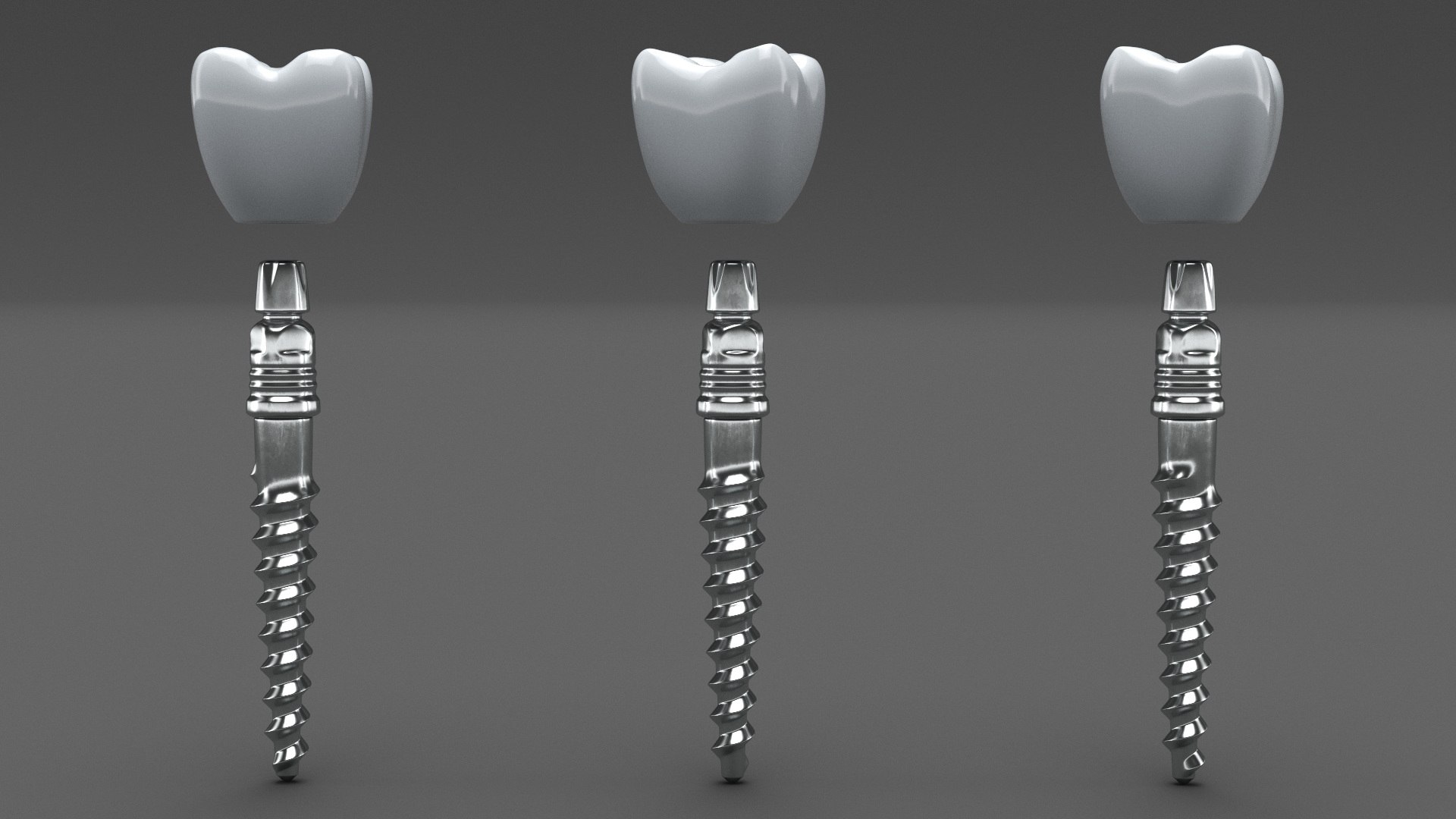 3D Tooth Implants Collection 4 https://p.turbosquid.com/ts-thumb/XR/EkHB9y/re/toothimplantscollection43dmodel019/jpg/1706530560/1920x1080/fit_q87/552205c885f6db85287d6a7500a925773a798afa/toothimplantscollection43dmodel019.jpg