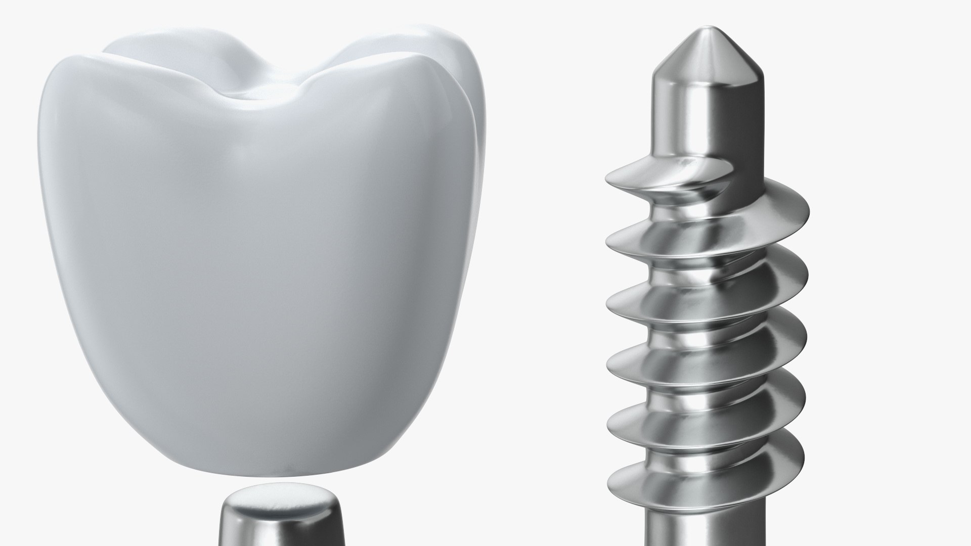 3D Tooth Implants Collection 4 https://p.turbosquid.com/ts-thumb/XR/EkHB9y/ux/toothimplantscollection43dmodel036/jpg/1706530636/1920x1080/fit_q87/7e5dbcc370ba2bb6468616ac5fe09a91dbc8e24e/toothimplantscollection43dmodel036.jpg