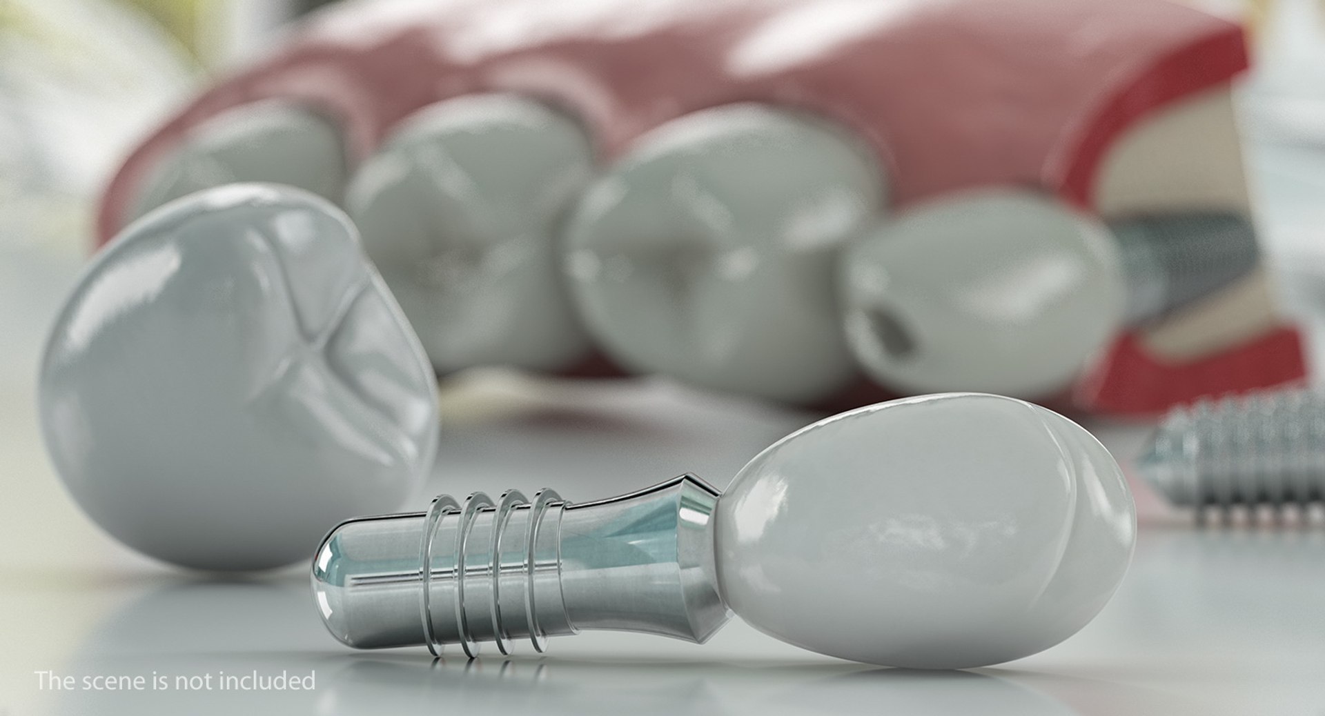 3D Tooth Implants Collection 4 https://p.turbosquid.com/ts-thumb/XR/EkHB9y/wz/toothimplantscollection43dmodel068/jpg/1706530779/1920x1080/fit_q87/6b94decd3e7396dce47acd19df3e88a692370426/toothimplantscollection43dmodel068.jpg