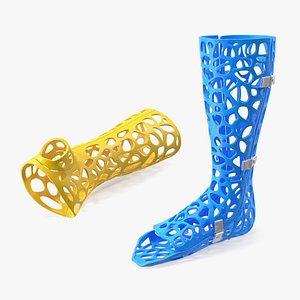 3D-Printed Orthopedic Casts Collection 3D model