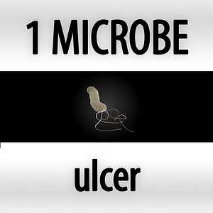 ulcer - heliobacter pylori