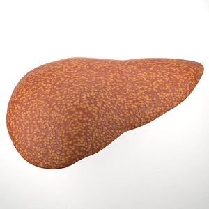 3D cirrhosis of the liver