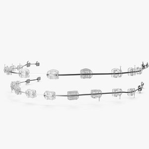 Transparent Dental Braces V04 3D model