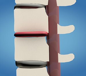 spine compression model