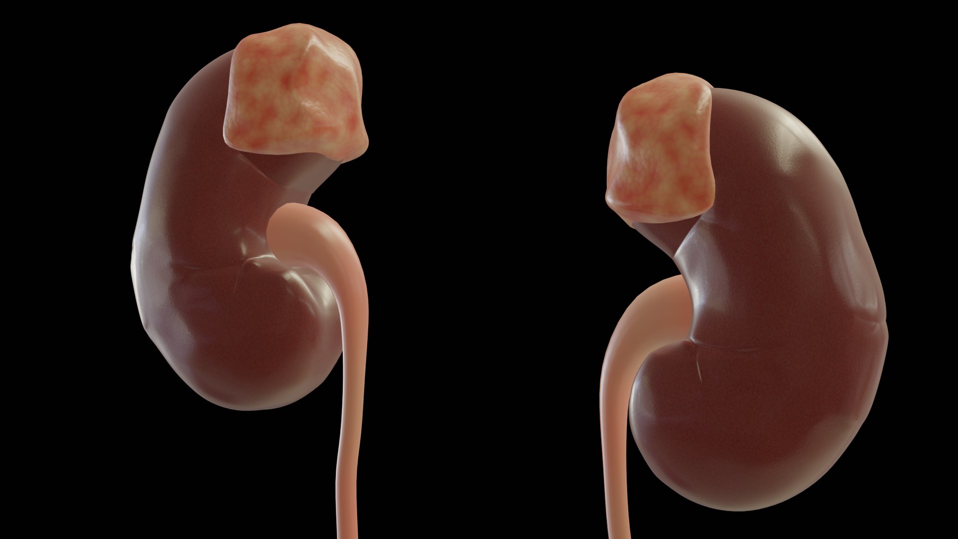 urinary model https://p.turbosquid.com/ts-thumb/Y5/J2edbl/3Ytc9yWf/presp_other/png/1567715980/1920x1080/fit_q87/a2322dc468041d3aeff3e2422ec3a4c560bb3e21/presp_other.jpg