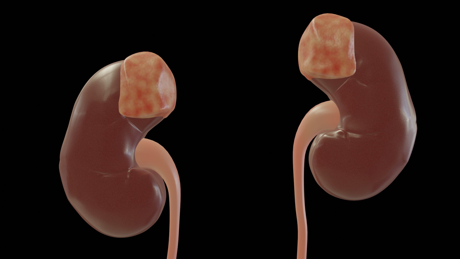 urinary model https://p.turbosquid.com/ts-thumb/Y5/J2edbl/i1sAckFK/portada/png/1567716133/1920x1080/fit_q87/cb14863fd0a13e251e749b70129f7973dac2cc63/portada.jpg