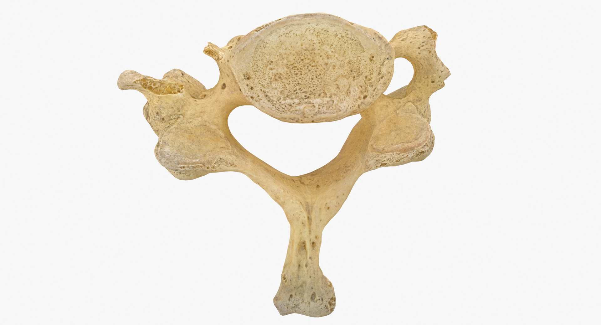 3D Human Ribs and Spine Bones Collection White and Yellow - 48 models https://p.turbosquid.com/ts-thumb/YD/F1Q7rH/Sd/0000/jpg/1616498054/1920x1080/turn_fit_q99/732ea82d5f77c3aecc870117429ce39182fdf929/0000-1.jpg