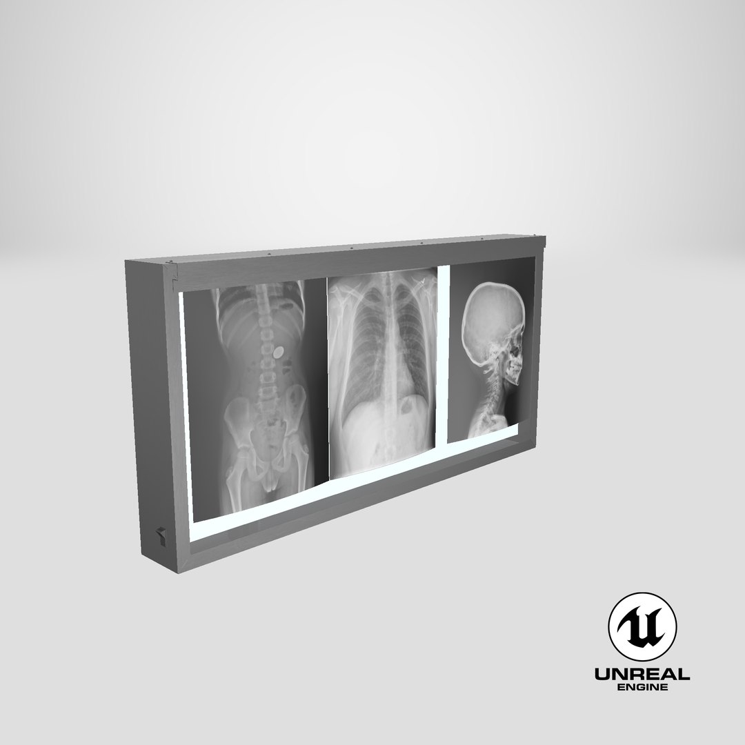 3d model xray light box x https://p.turbosquid.com/ts-thumb/YD/Iglfu0/1d/stemcell_unreal_render/png/1635957509/1920x1080/fit_q87/c659256c444de35ecc181c7329abcd40138146d7/stemcell_unreal_render.jpg