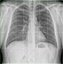 XRay Light Box