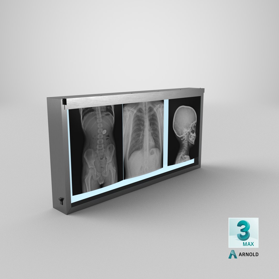 3d model xray light box x https://p.turbosquid.com/ts-thumb/YD/Iglfu0/SE/stemcell_max_arnold_render/png/1635957510/1920x1080/fit_q87/1a779e367f698c32ef1b133e4704e622dd2646e8/stemcell_max_arnold_render.jpg