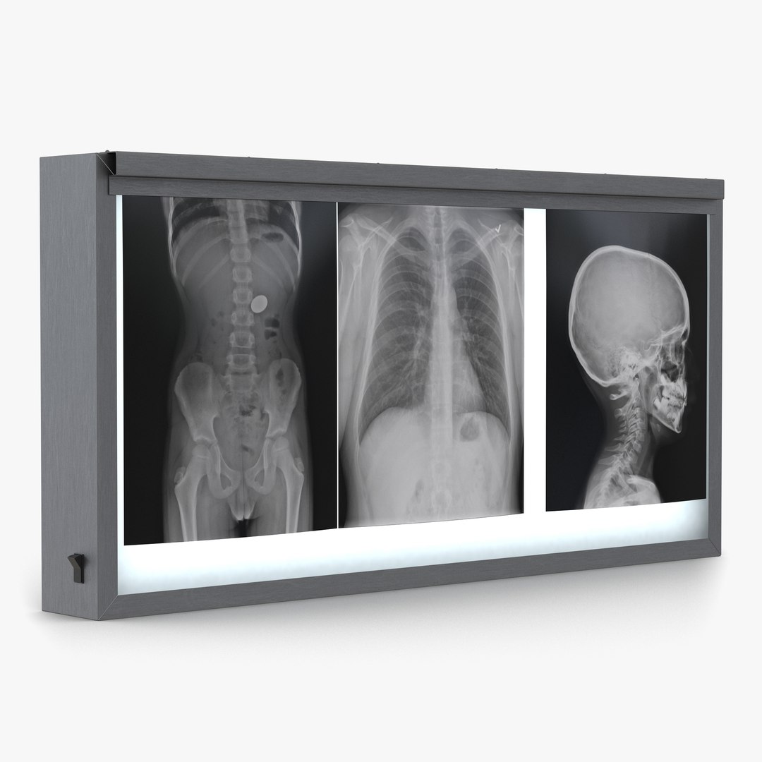 XRay Light Box 3D model preview