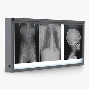 XRay Light Box
