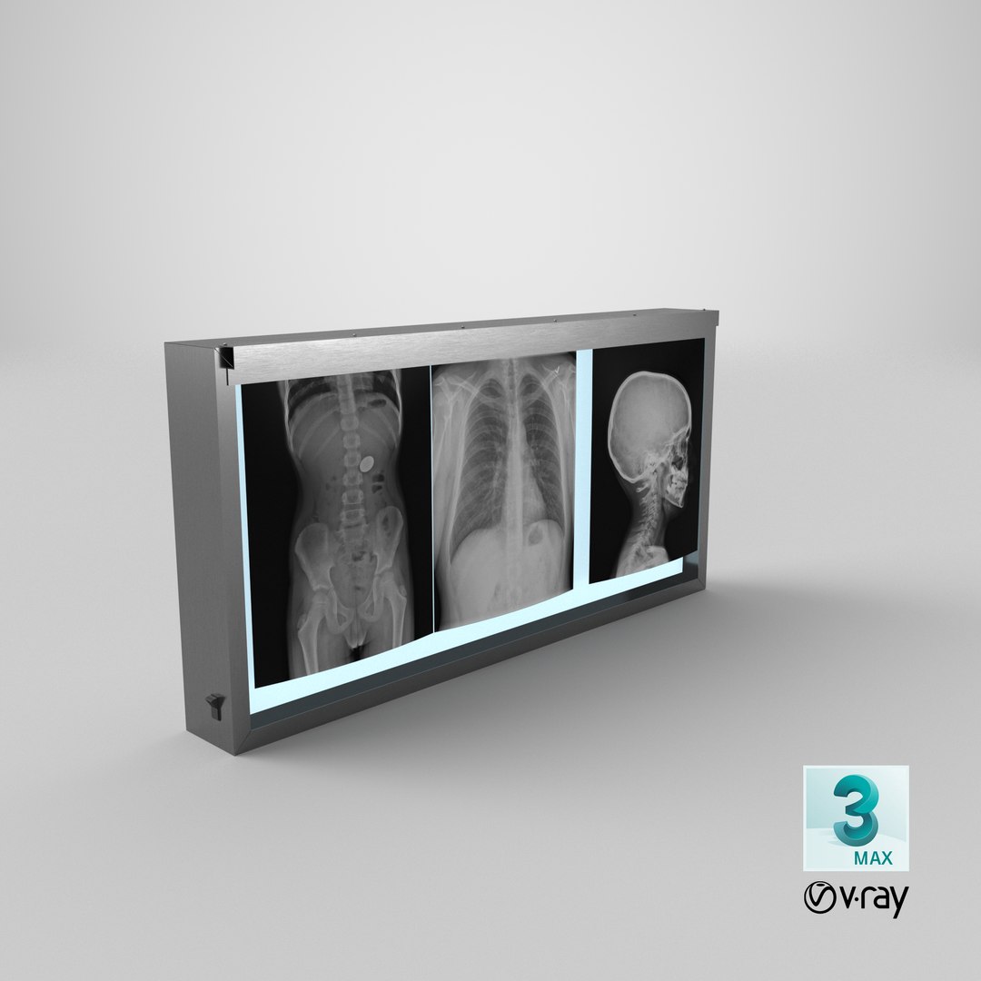 3d model xray light box x https://p.turbosquid.com/ts-thumb/YD/Iglfu0/Up/stemcell_max_vray_render/png/1635957512/1920x1080/fit_q87/c3b4af67750ad5354c0de83f49be5da67dbcd29c/stemcell_max_vray_render.jpg