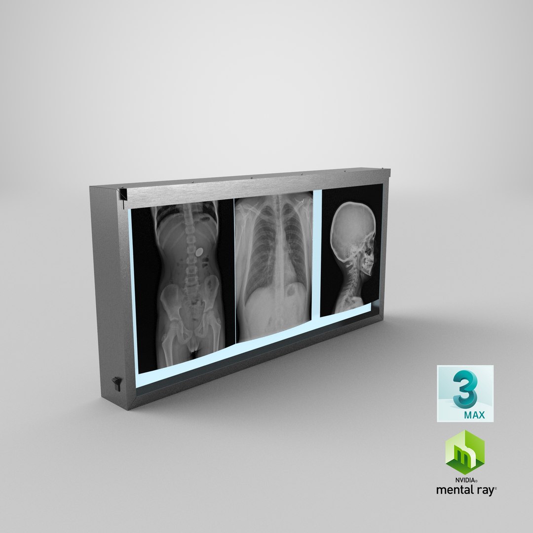 3d model xray light box x https://p.turbosquid.com/ts-thumb/YD/Iglfu0/an/stemcell_max_mental_ray_render/png/1635957511/1920x1080/fit_q87/10d19137a08df1cae24c8c1dfef7988061c751f9/stemcell_max_mental_ray_render.jpg