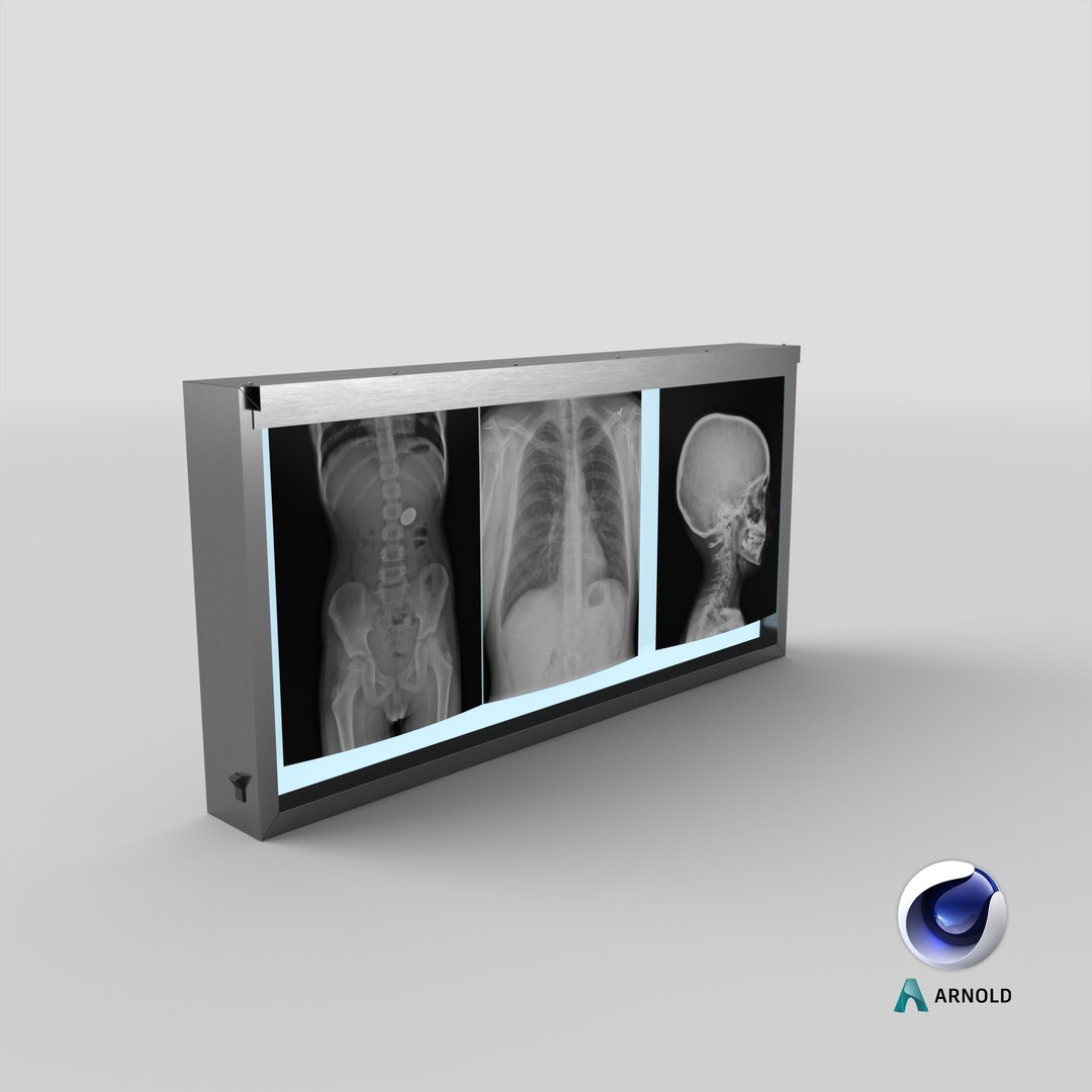3d model xray light box x https://p.turbosquid.com/ts-thumb/YD/Iglfu0/e5/stemcell_cinema_4d_arnold_render/png/1635957507/1920x1080/fit_q87/dcdc515dde5b7b56463f460b9c6be2200e9ab36e/stemcell_cinema_4d_arnold_render.jpg