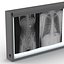 XRay Light Box