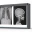 XRay Light Box