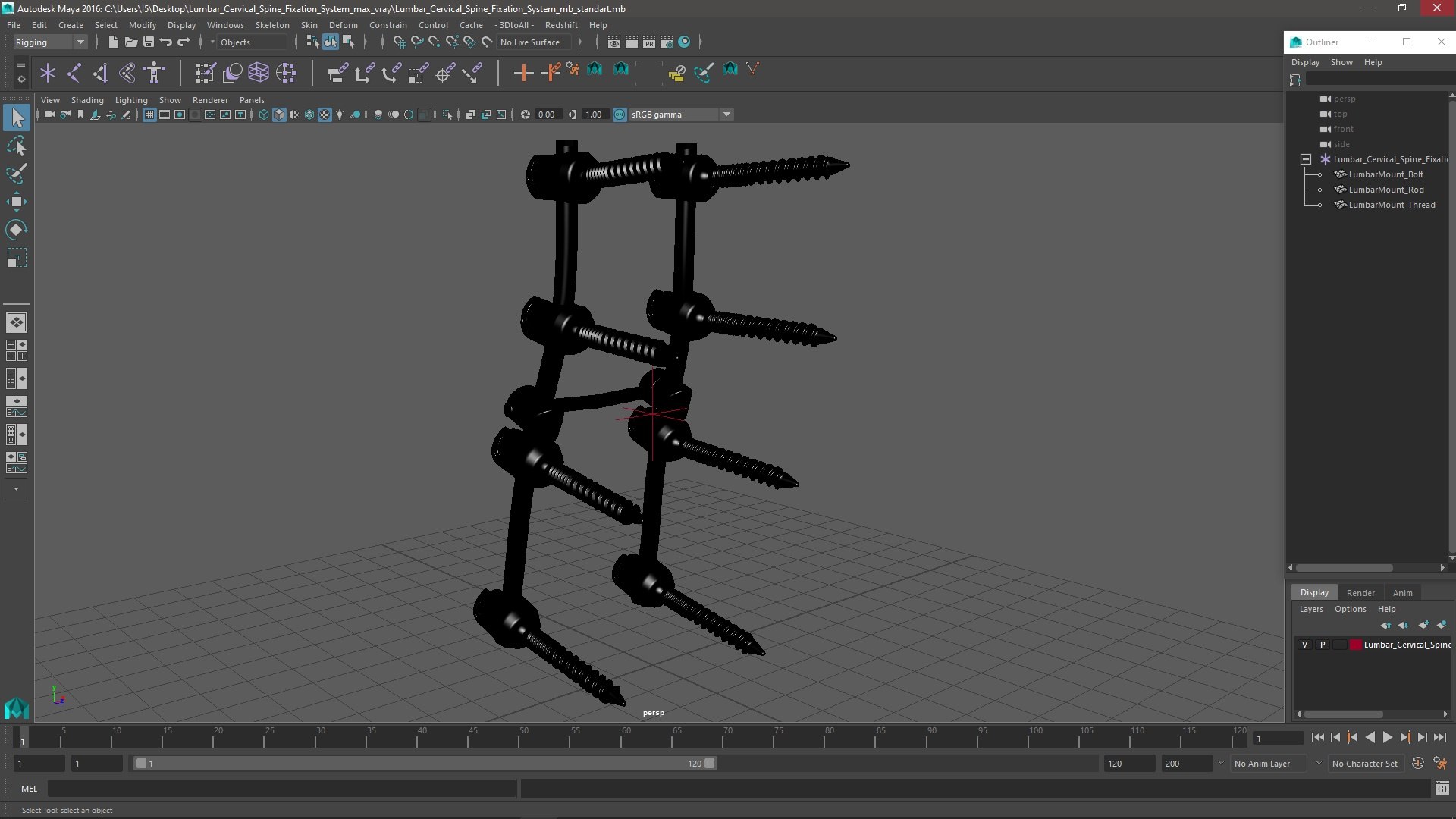 3D Lumbar Cervical Spine Fixation System https://p.turbosquid.com/ts-thumb/YD/qeCwAE/GY/lumbarcervicalspinefixationsystem3dmodel024/jpg/1710694897/1920x1080/fit_q87/b2ecc4c49efa83ca2a8c9e82246f242833d79c44/lumbarcervicalspinefixationsystem3dmodel024.jpg