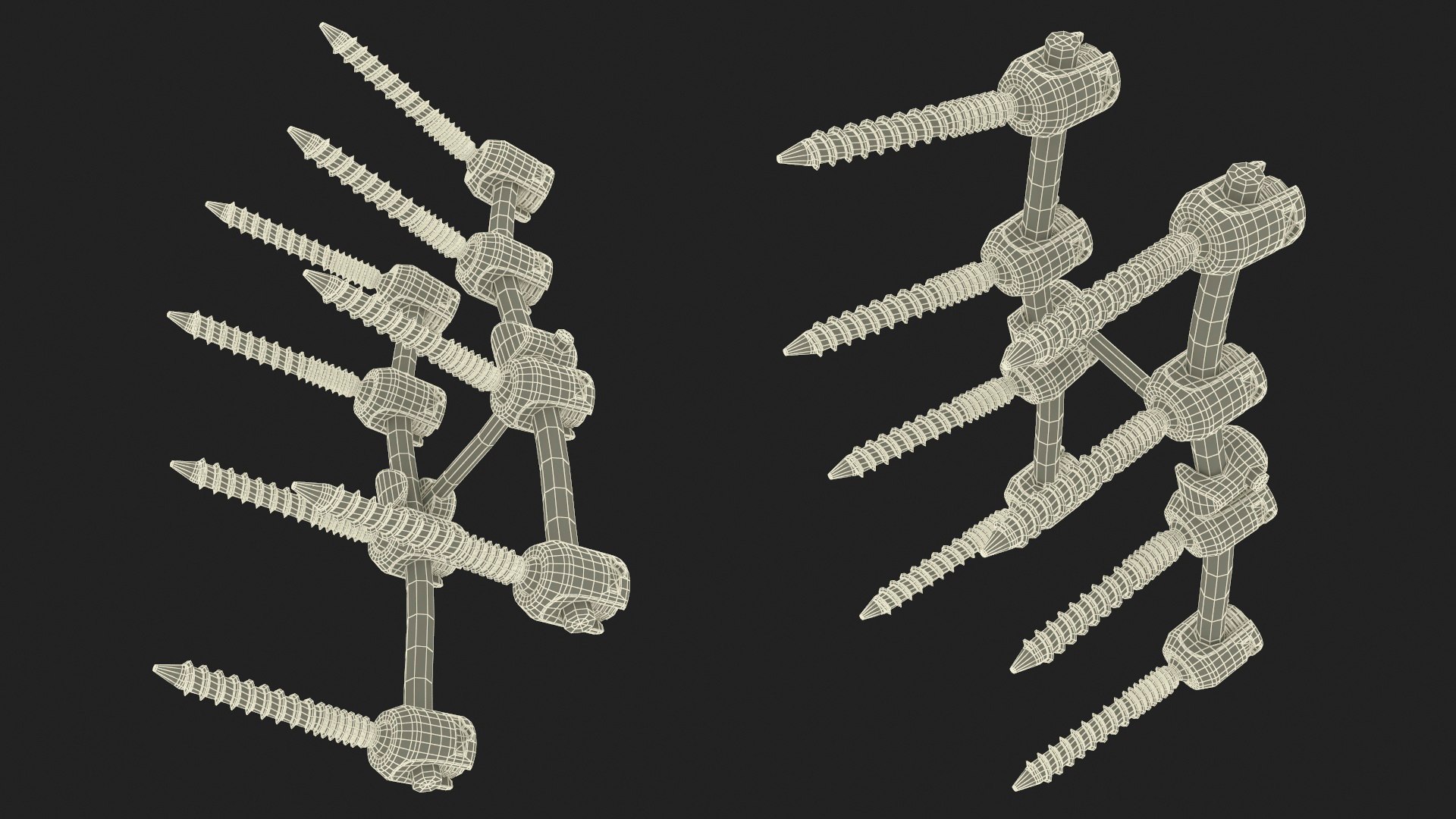 3D Lumbar Cervical Spine Fixation System https://p.turbosquid.com/ts-thumb/YD/qeCwAE/V4/lumbarcervicalspinefixationsystem3dmodel027/jpg/1710694905/1920x1080/fit_q87/0deb66458cd822d5d48f4ce5df909c86faf8795b/lumbarcervicalspinefixationsystem3dmodel027.jpg