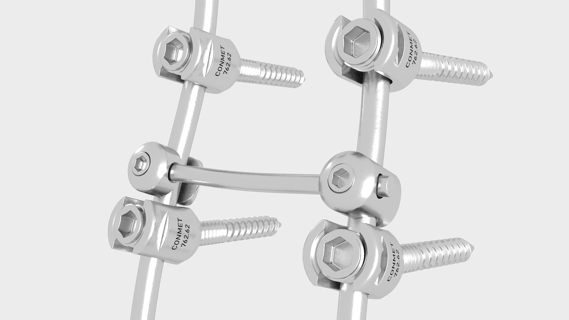 3D Lumbar Cervical Spine Fixation System https://p.turbosquid.com/ts-thumb/YD/qeCwAE/cx/lumbarcervicalspinefixationsystem3dmodel015/jpg/1710694873/1920x1080/fit_q87/41c1797f13b901a99933b0b52914732aab075172/lumbarcervicalspinefixationsystem3dmodel015.jpg