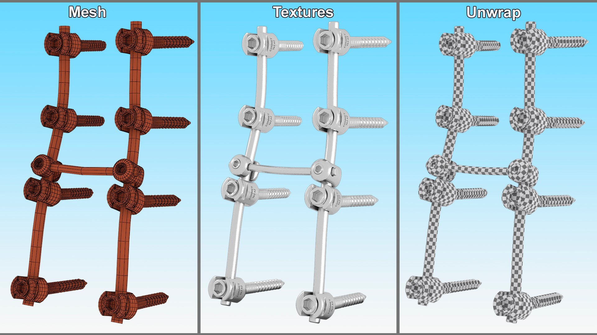3D Lumbar Cervical Spine Fixation System https://p.turbosquid.com/ts-thumb/YD/qeCwAE/hG/lumbarcervicalspinefixationsystem3dmodel016/jpg/1710694876/1920x1080/fit_q87/9201b585c3a00e7e4a5cb180304ed1b801170ed1/lumbarcervicalspinefixationsystem3dmodel016.jpg