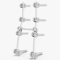 Lumbar Cervical Spine Fixation System