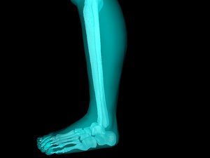 x ankle joint 3ds