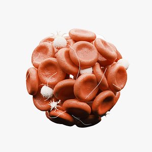 Blood Clot Thrombus 3D model