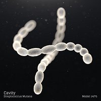 Cavity - Streptococcus Mutans
