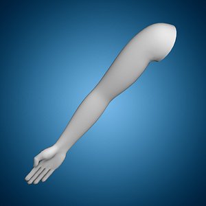 Arm